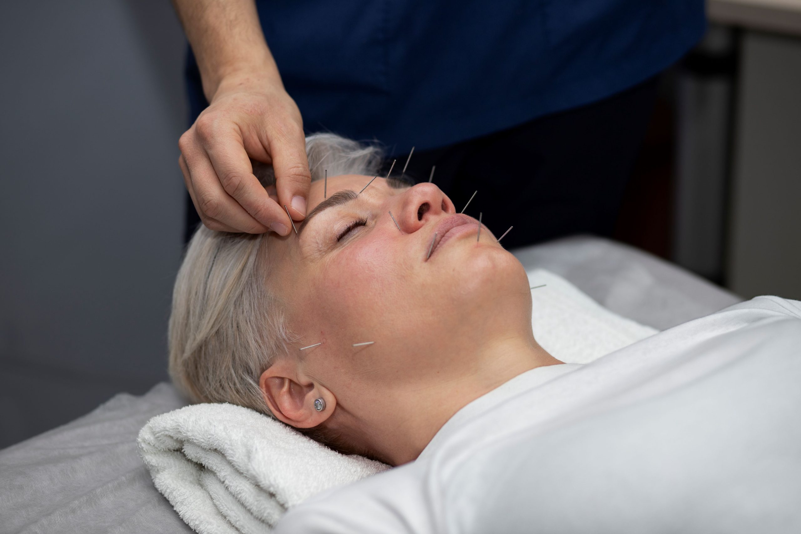 petite_traitement-acupuncture-femme-grand-angle